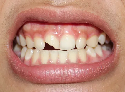 Copper Hills Dental gallery